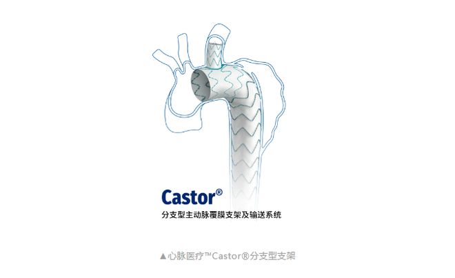 聚龄医疗器械WMS用户心脉医疗Castor分支型支架荣获中国金奖(图1)